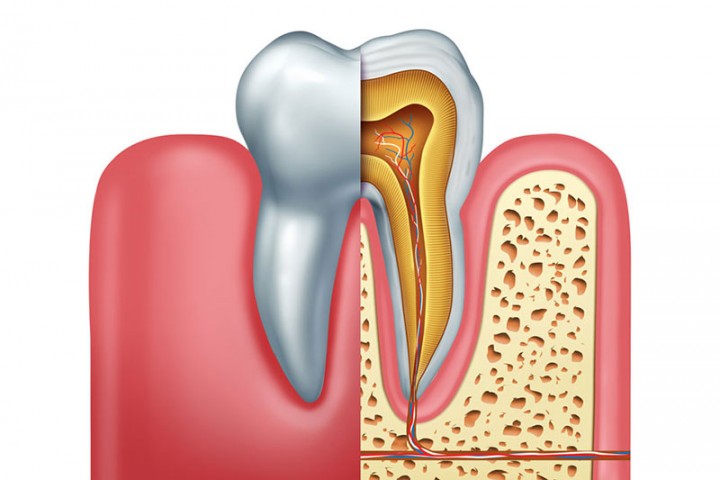 Periodoncia en Zafra, Badajoz