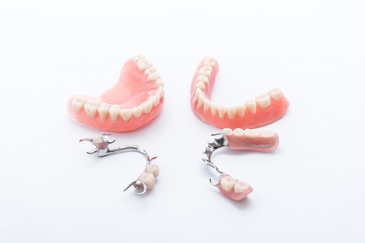 prótesis dentales en Zafra, Badajoz