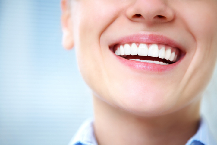 Tratamientos para la sonrisa gingival