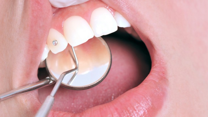 grillz