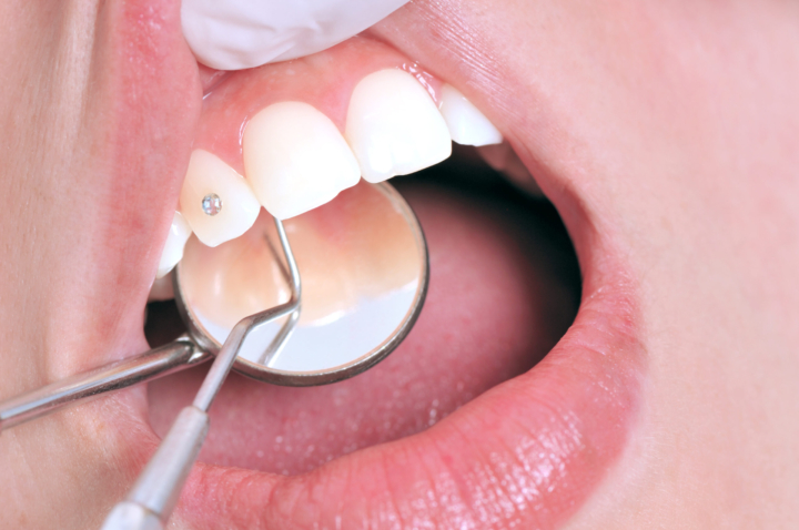 grillz