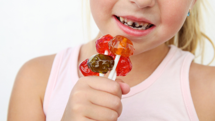 niños dientes negros