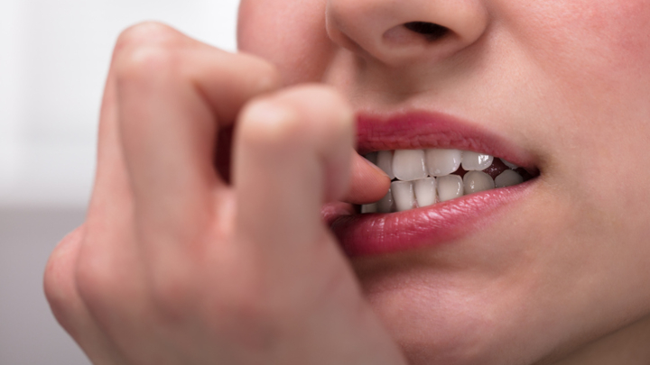 malos hábitos dentales